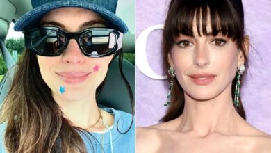 Anne Hathaway Wears Pimple Patches in Relatable Selfie: ‘Stars, They’re Just Like Us’