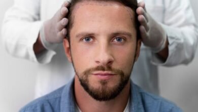 10 Advice to Find the Best Hair Transplant Clinic in Turkey – Chart Attack